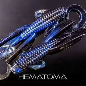 Man Bear Pig Hematoma